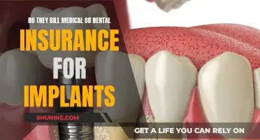 Implant Billing: Medical or Dental Insurance Coverage?