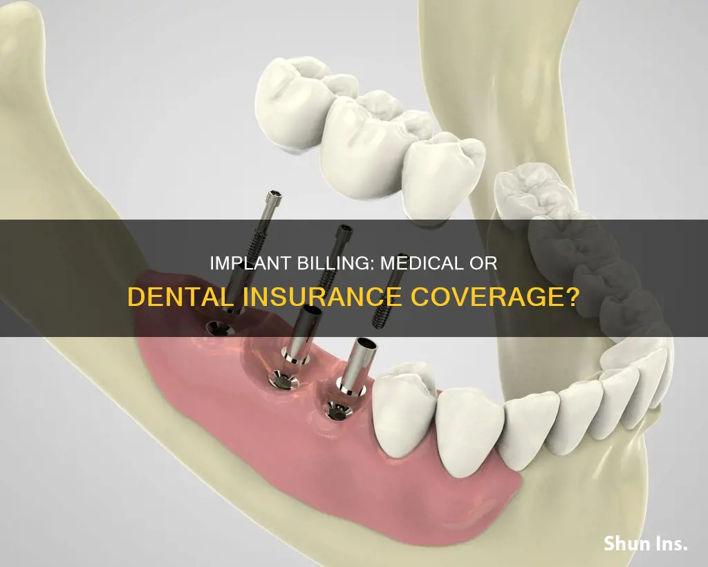 do they bill medical or dental insurance for implants