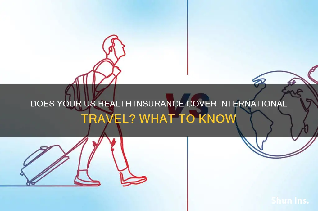 do us health insurance cover you internationally