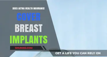 Aetna Health Insurance Coverage for Breast Implants: What You Need to Know