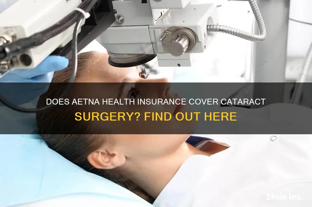 does aetna health insurance cover cataract surgery