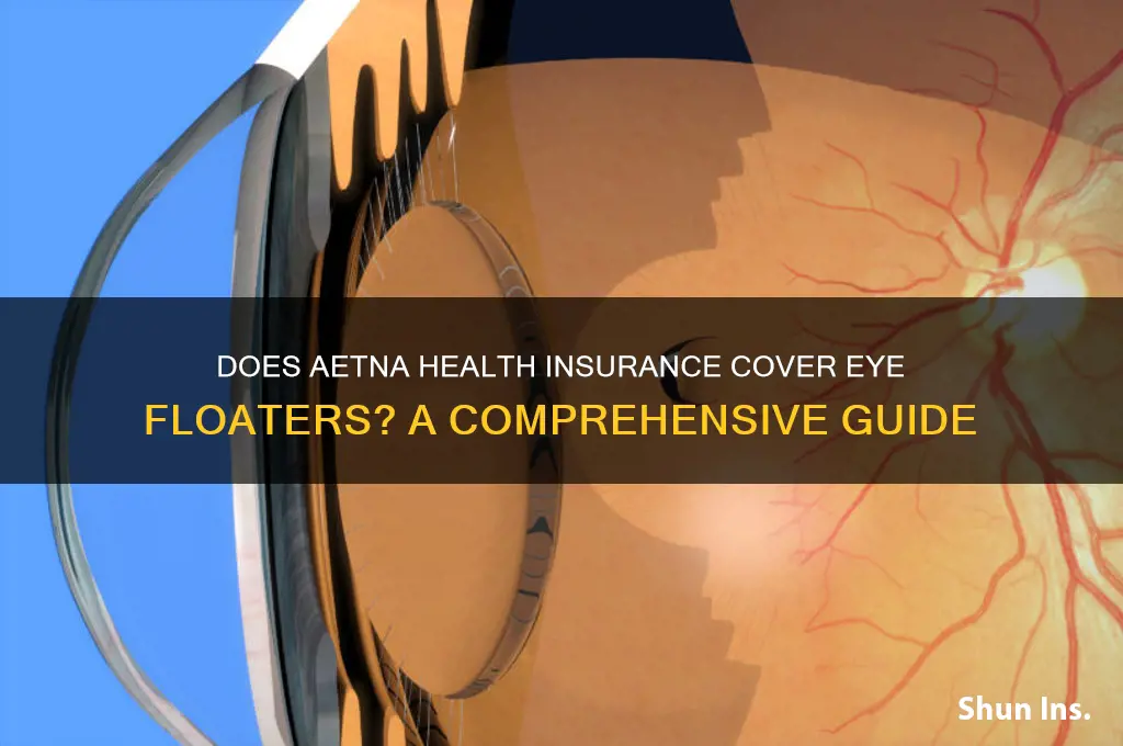 does aetna health insurance cover eye floater