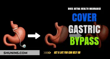 Aetna Health Insurance Coverage for Gastric Bypass: What You Need to Know