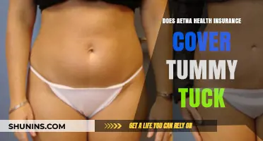 Aetna Health Insurance Coverage for Tummy Tuck Procedures Explained