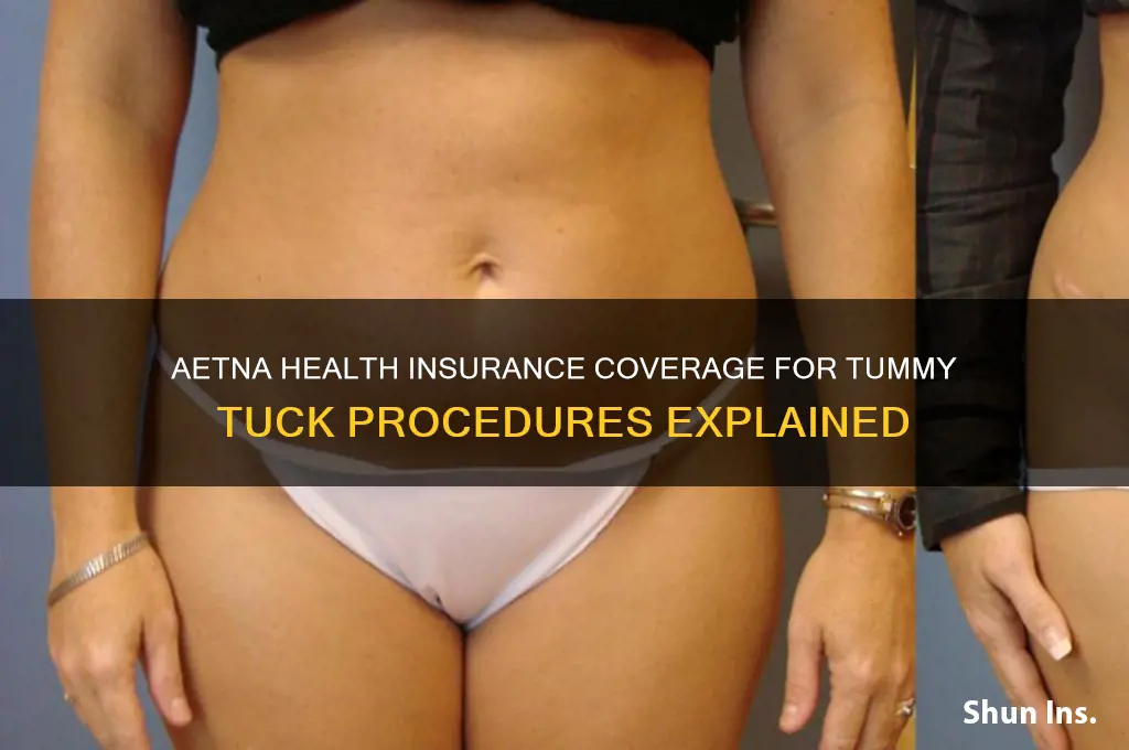 does aetna health insurance cover tummy tuck