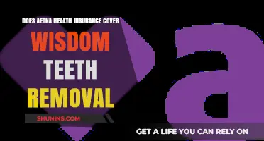 Does Aetna Health Insurance Cover Wisdom Teeth Removal? Find Out