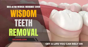 Aetna Medical Insurance: Wisdom Teeth Removal Coverage?