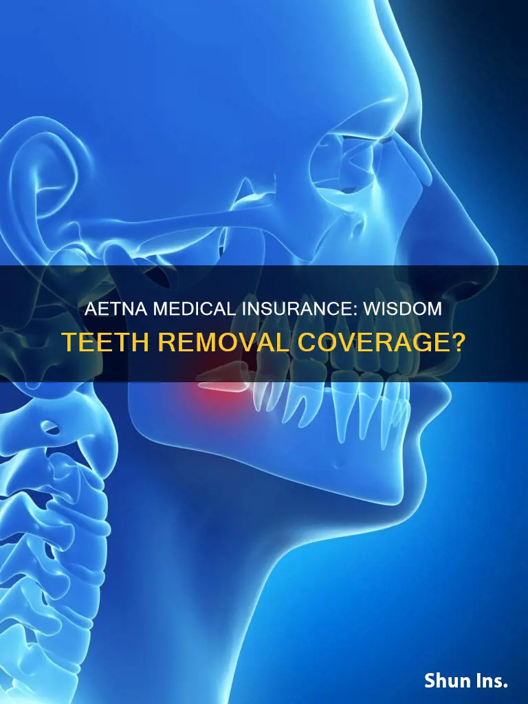 does aetna medical insurance cover wisdom teeth removal