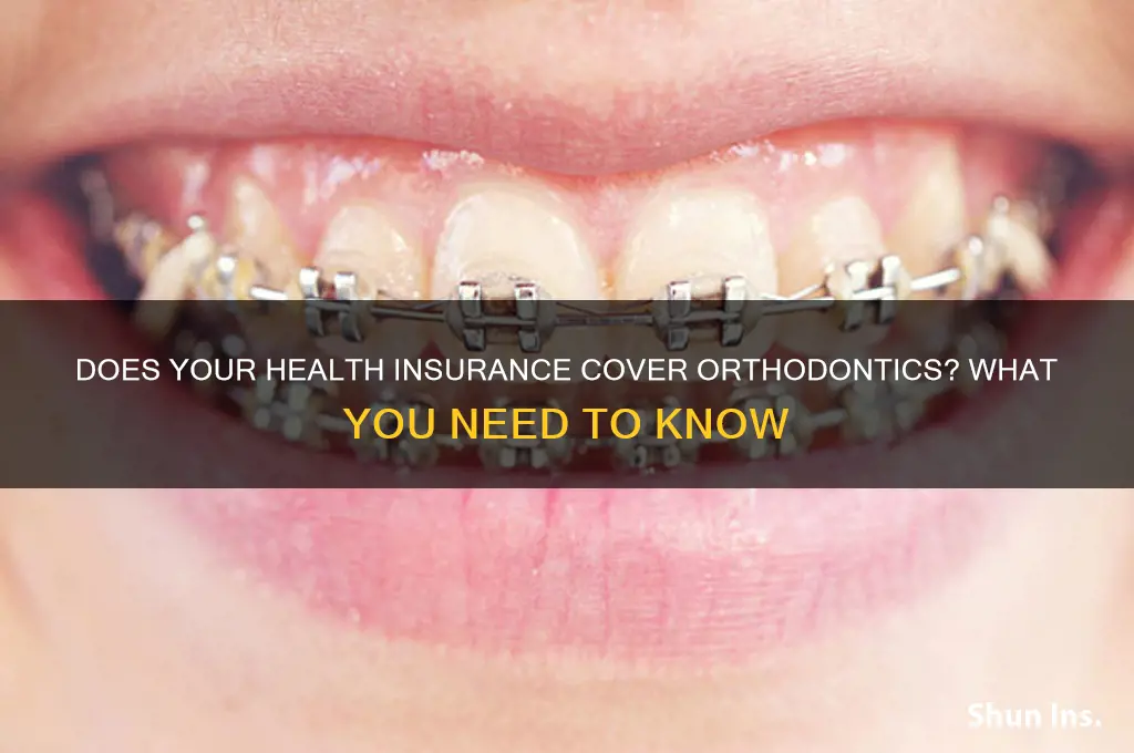does all health insurance cover orthodontics