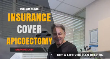 Does Health Insurance Cover Apicoectomy? A Comprehensive Guide