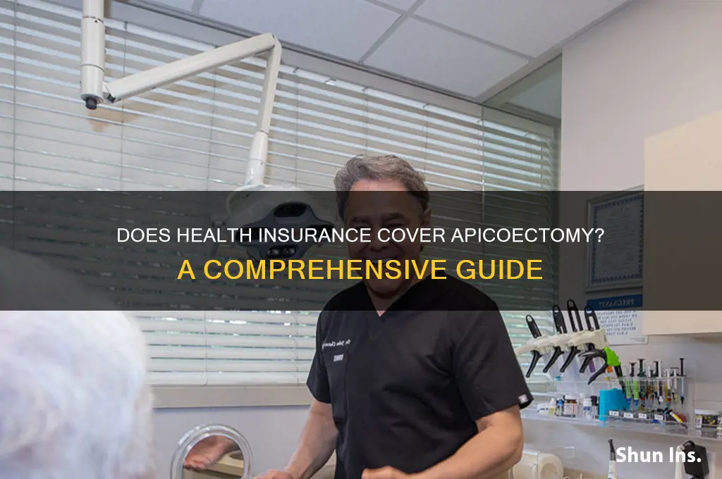 does any health insurance cover apicoectomy