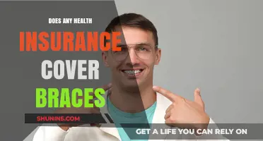 Does Health Insurance Cover Braces? Exploring Coverage Options for Orthodontic Care