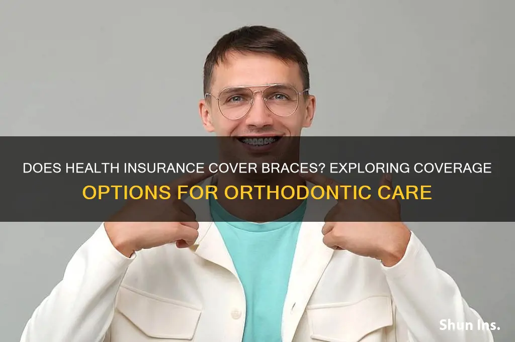 does any health insurance cover braces