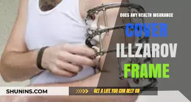 Does Health Insurance Cover Ilizarov Frame Treatment? A Comprehensive Guide
