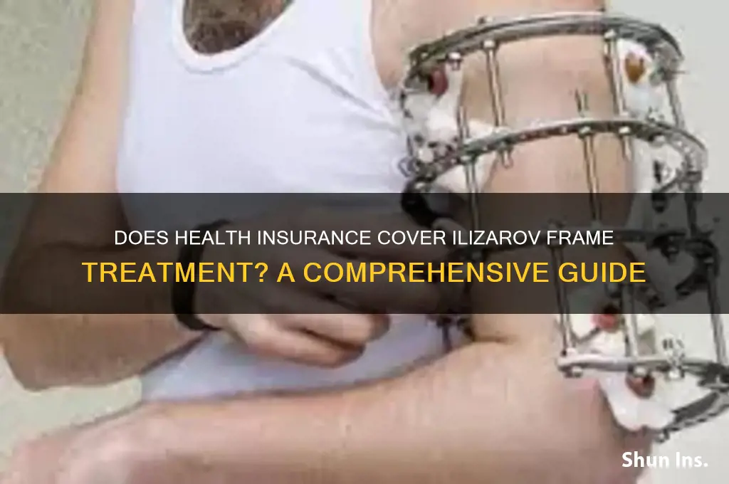 does any health insurance cover illzarov frame