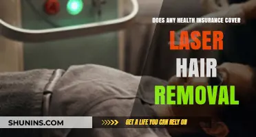 Does Health Insurance Cover Laser Hair Removal? What You Need to Know