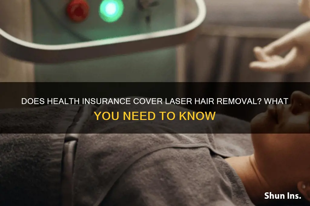 does any health insurance cover laser hair removal