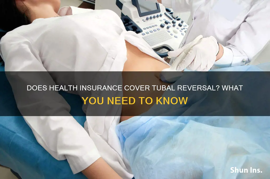 does any health insurance cover tuble reversal