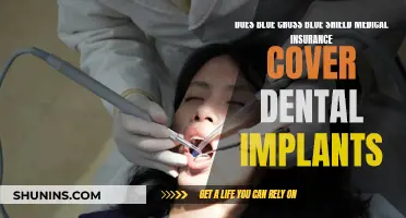Blue Cross Blue Shield: Dental Implant Coverage Explained