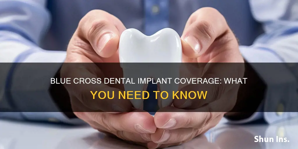 does blue cross medical insurance cover dental implants