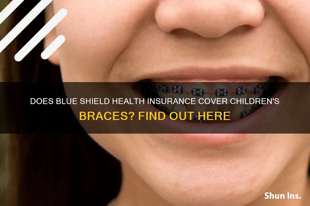 does blue shield health insurance cover children braces
