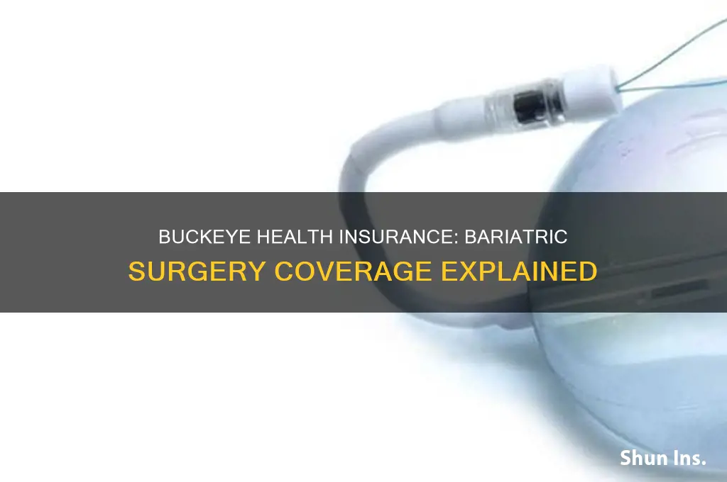 does buckeye health insurance cover bariatric surgery