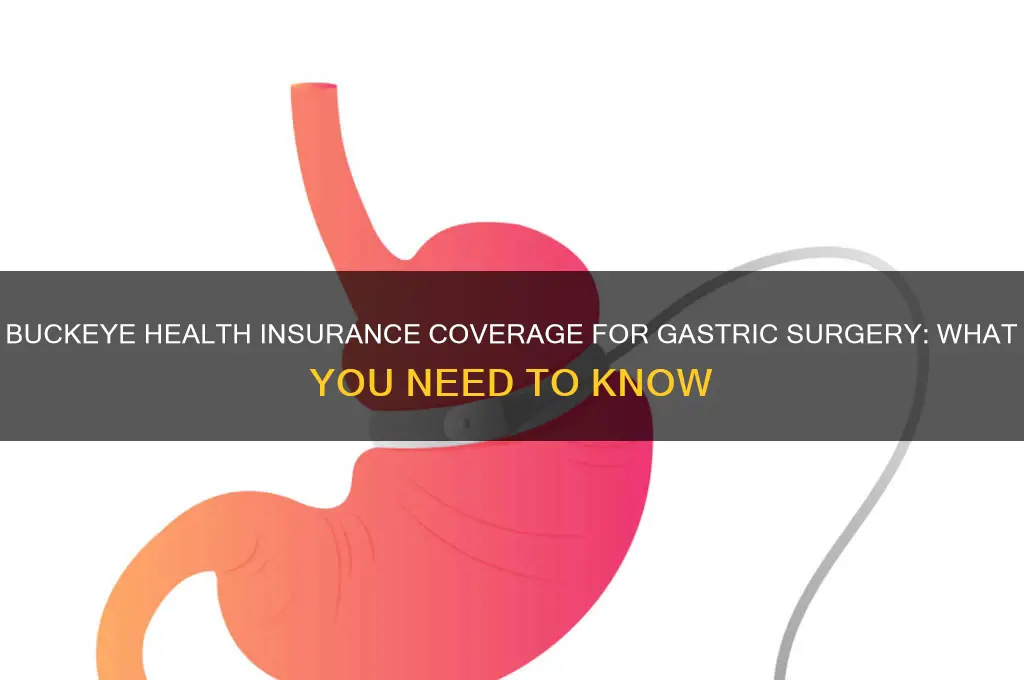 does buckeye health insurance cover gastric surgery