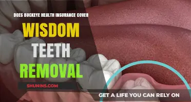 Does Buckeye Health Insurance Cover Wisdom Teeth Removal?