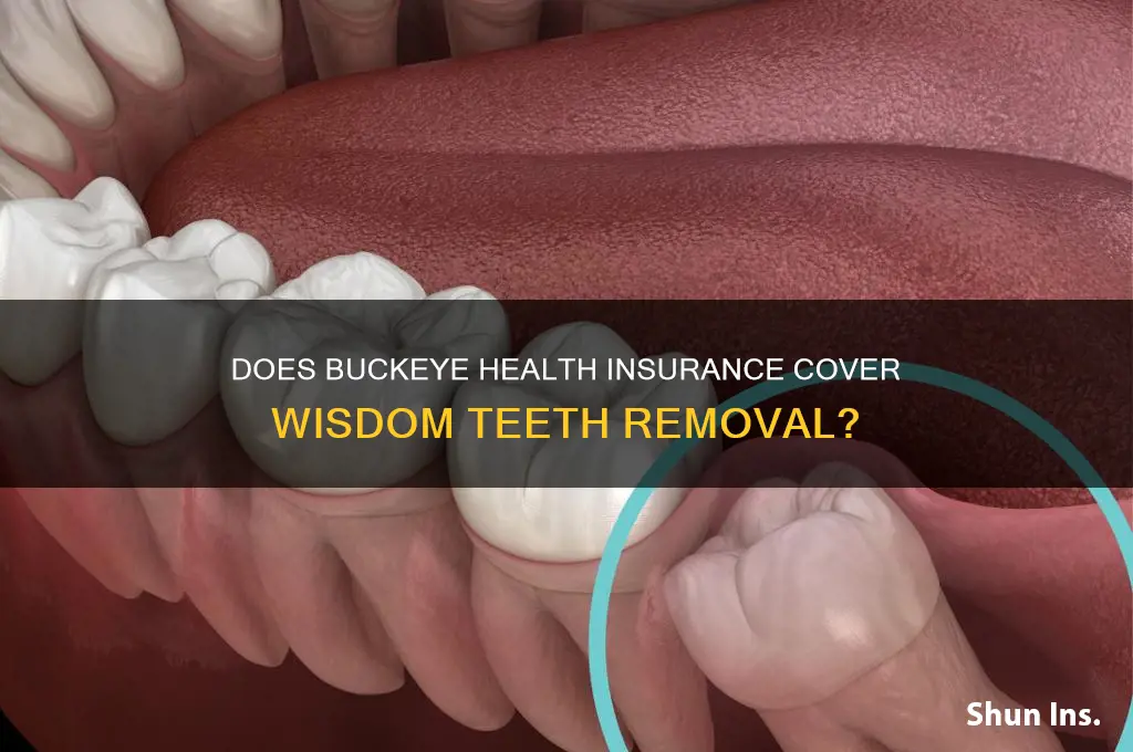 does buckeye health insurance cover wisdom teeth removal