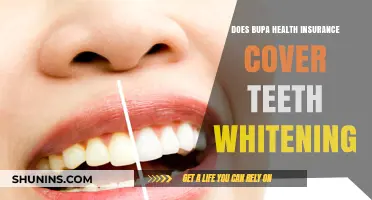 Bupa Health Insurance: Does It Cover Teeth Whitening Treatments?