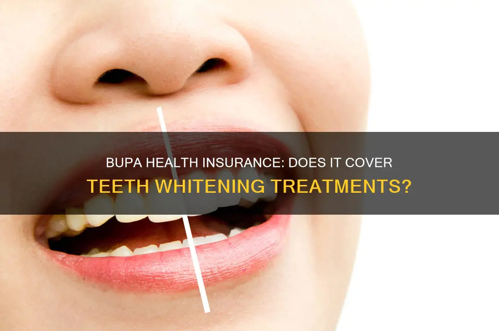 does bupa health insurance cover teeth whitening