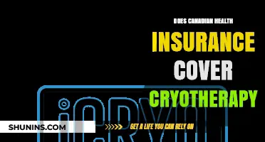 Does Canadian Health Insurance Cover Cryotherapy? What You Need to Know