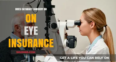 Cataract Surgery: What Eye Insurance Covers