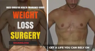 Christus Health Insurance Coverage for Weight Loss Surgery: What You Need to Know