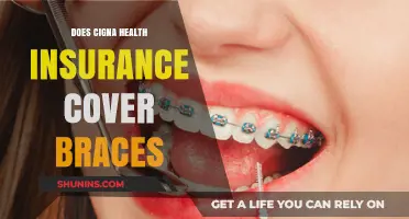 Does Cigna Health Insurance Cover Braces? A Comprehensive Guide