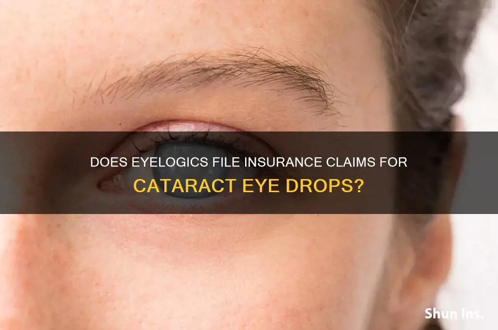does eyelogics file insurance for cataract eye drops