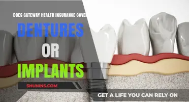 Gateway Health Insurance: Denture and Implant Coverage Explained
