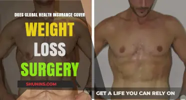 Global Health Insurance: Does It Cover Weight Loss Surgery?