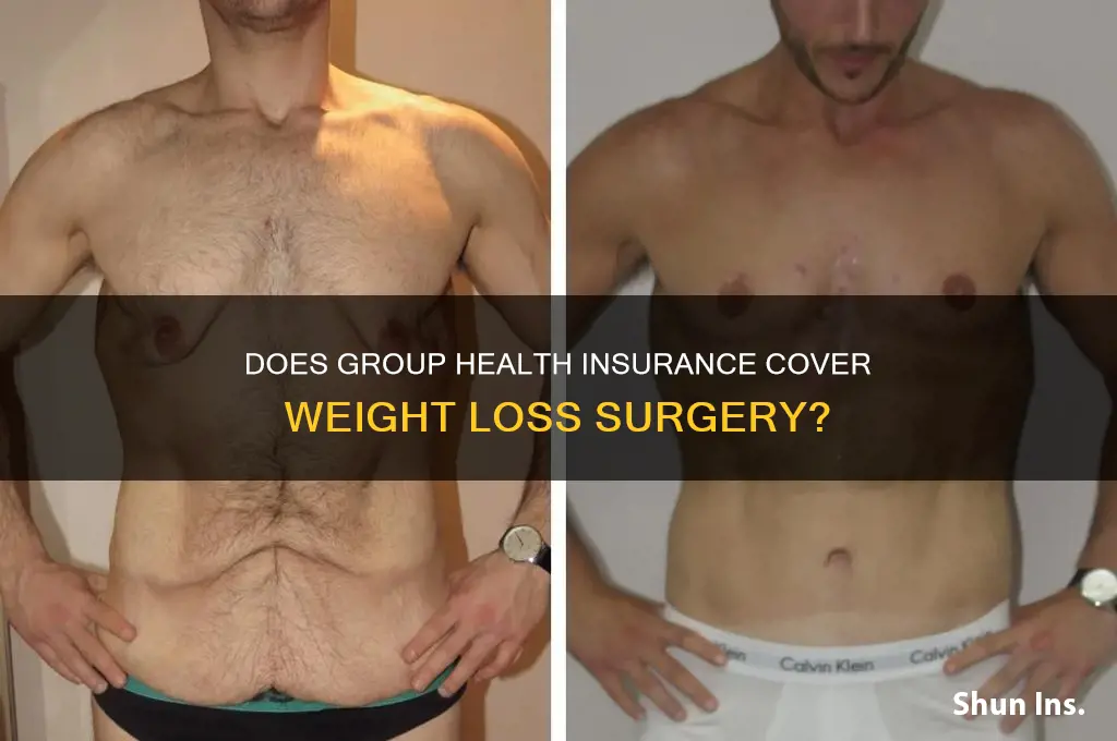 does group health insurance cover weight loss surgery