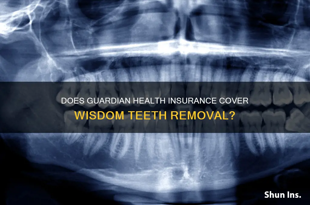 does guardian health insurance cover wisdom teeth