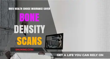 Health Choice Insurance Coverage for Bone Density Scans: What You Need to Know