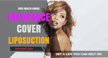Does Health Choice Insurance Cover Liposuction? What You Need to Know