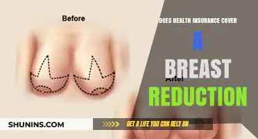 Does Health Insurance Cover Breast Reduction? What You Need to Know