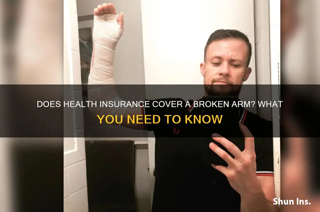 does health insurance cover a broken arm