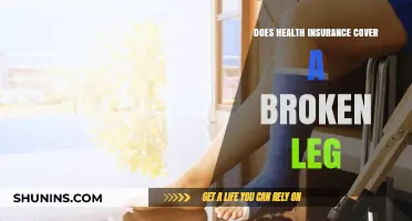 Does Health Insurance Cover a Broken Leg? What You Need to Know