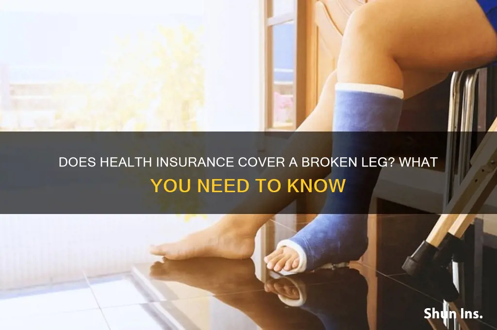 does health insurance cover a broken leg