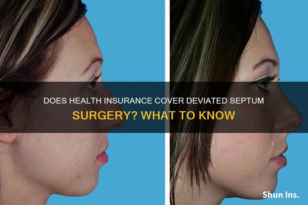 does health insurance cover a deviated septum