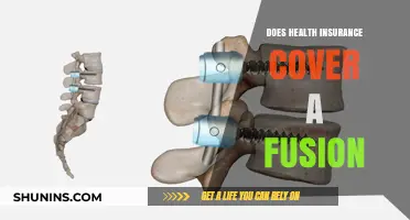 Does Health Insurance Cover Spinal Fusion Surgery? What to Know