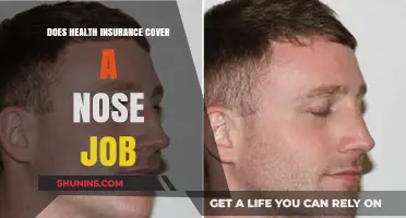 Does Health Insurance Cover a Nose Job? What You Need to Know