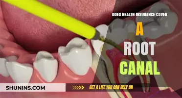 Does Health Insurance Cover Root Canals? What You Need to Know